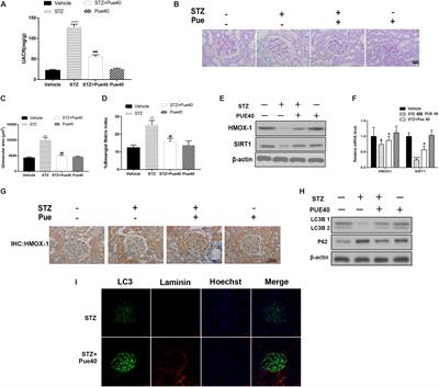 Puerarin Attenuates Diabetic Nephropathy by Promoting Autophagy in Podocytes